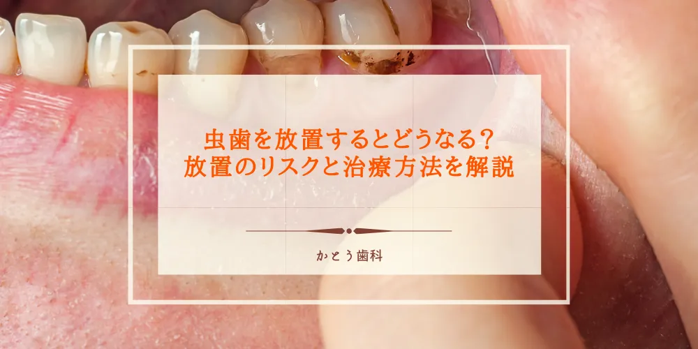 虫歯を放置するとどうなる？放置のリスクと治療方法を解説