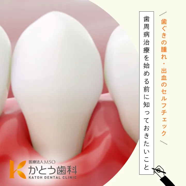 2025年11月14日_群馬で歯周病治療を始める前に知っておきたいこと|歯ぐきの腫れ・出血のセルフチェック
