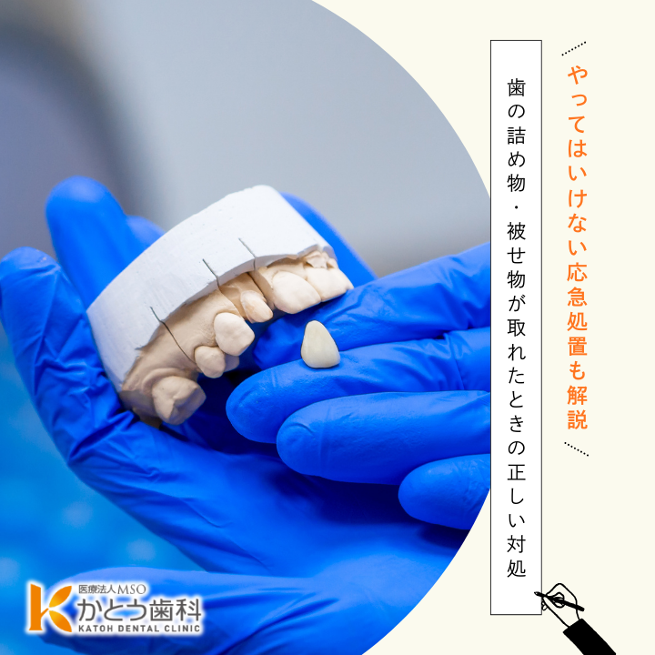 2026年3月6日_歯の詰め物・被せ物が取れたときの正しい対処｜やってはいけない応急処置も解説